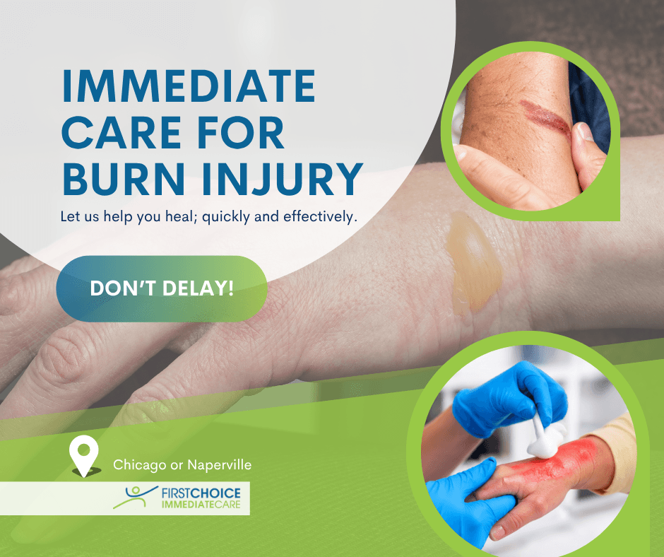 Landscape post 'Immediate Care for Burn Injury' with a Don't Delay button and two circular treatment photos